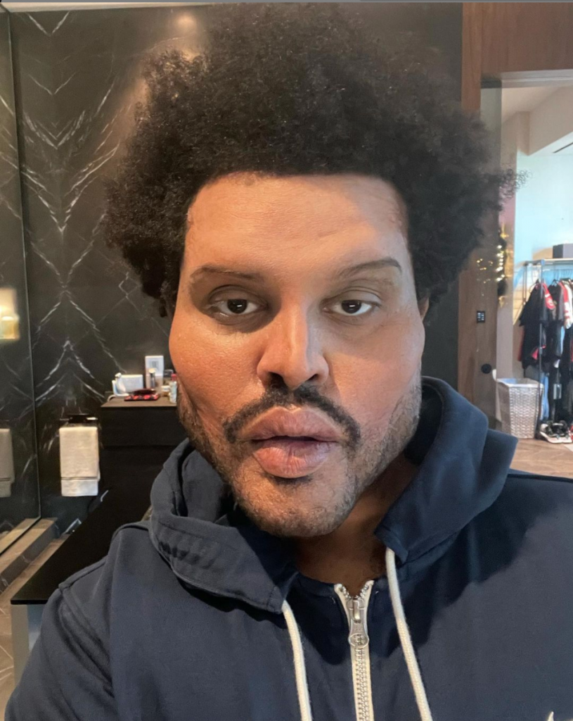 The Weeknd with prosthetics on