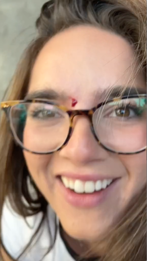 girl bleeding from forehead