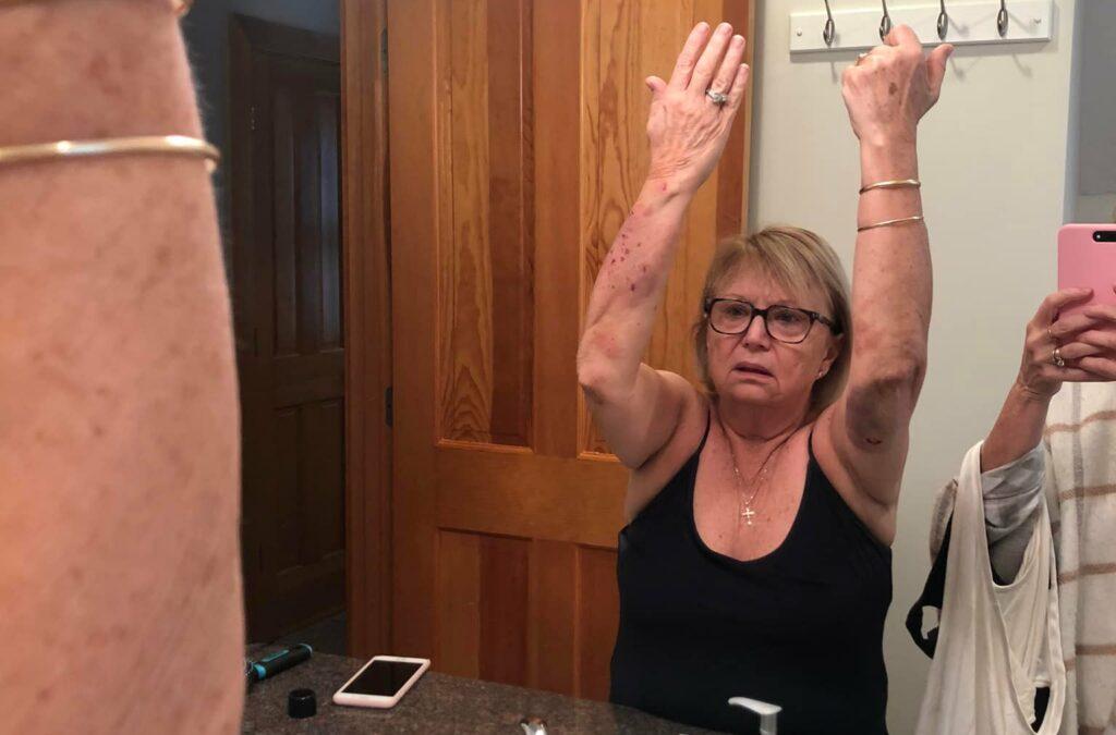 Woman Puts Raccoon In Headlock After Attack During Xmas Light Install(01)