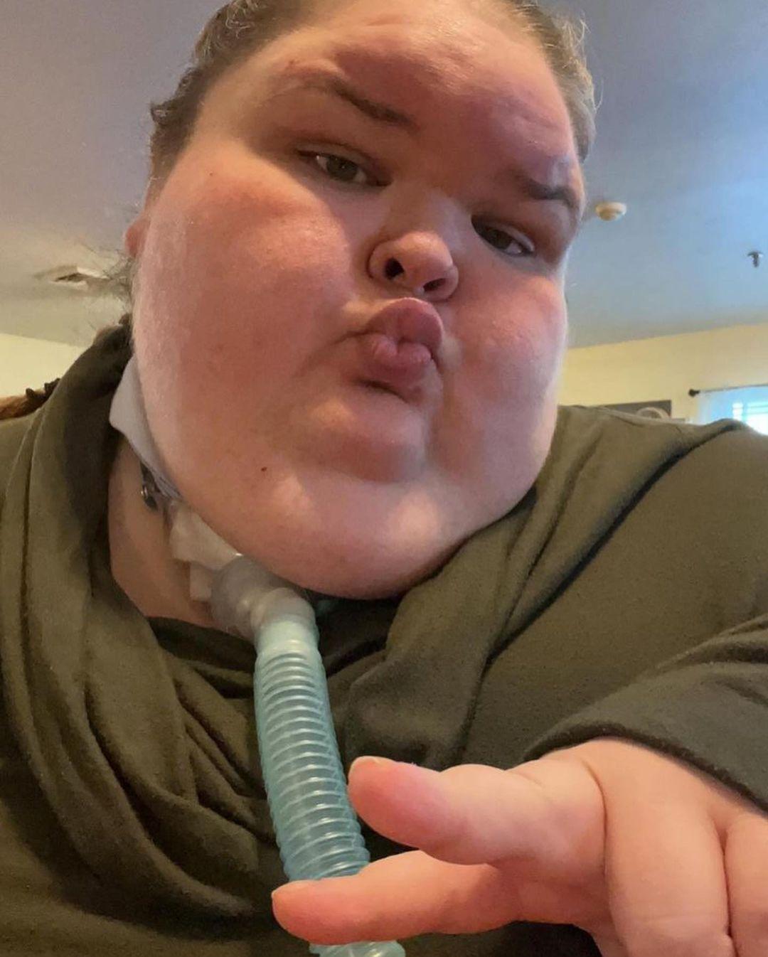 '1000-LB Sisters' Star Shares Shocking Photos With Tracheostomy Tube