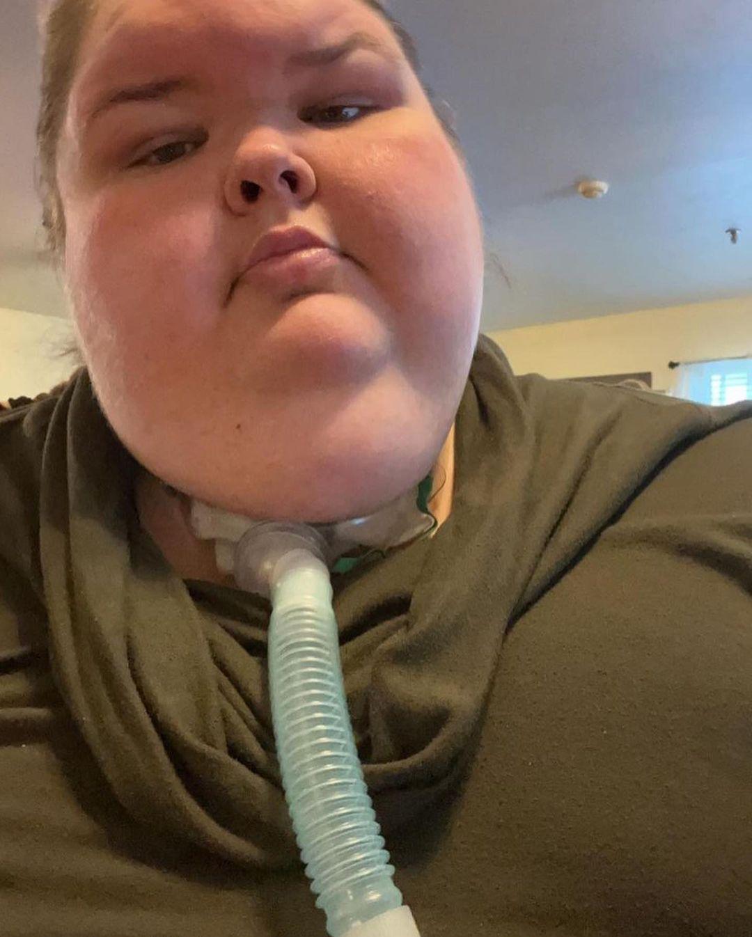 '1000-LB Sisters' Star Shares Shocking Photos With Tracheostomy Tube