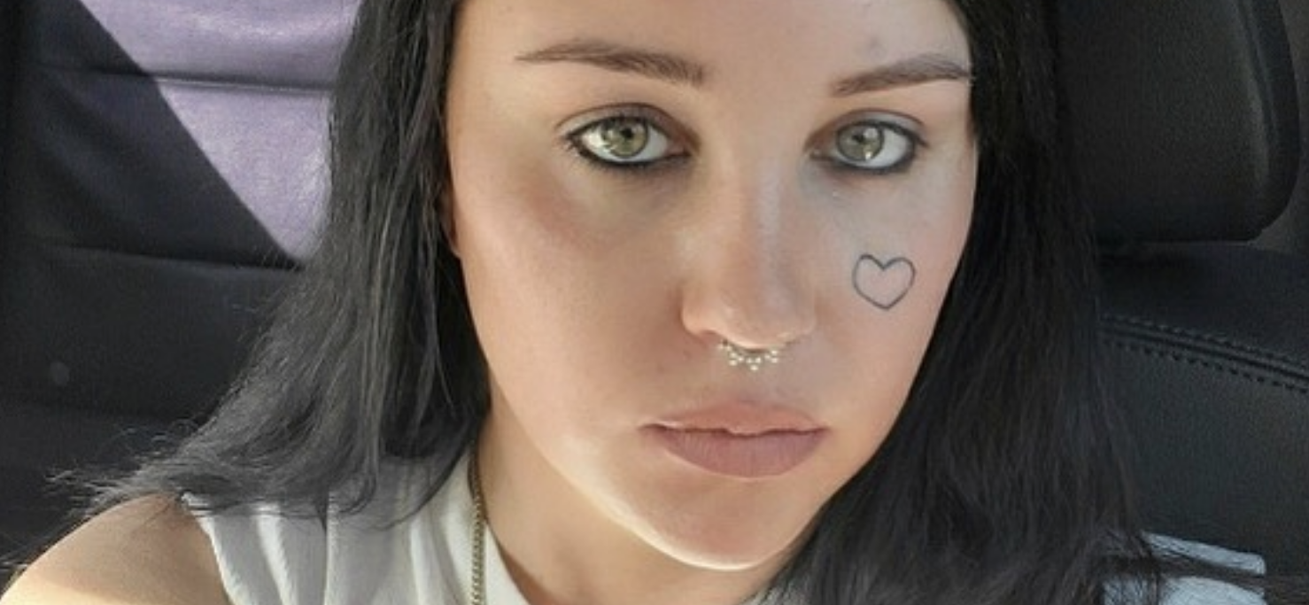Amanda Bynes Is Slowly Getting Rid Of Her Face Tattoo Amid Treatment At A Mental Facility