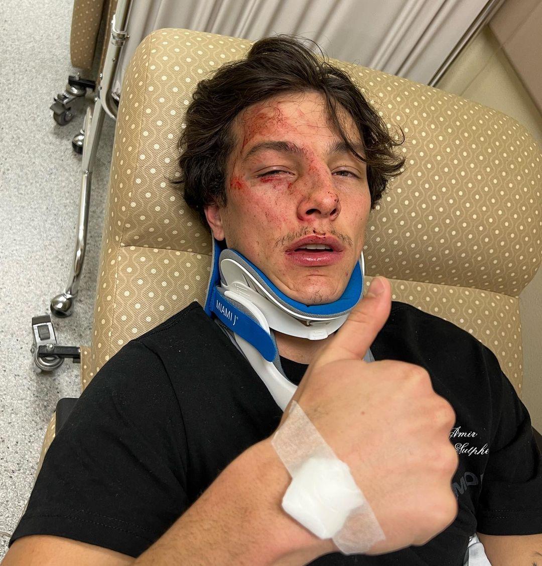 TikTok Star Tayler Holder Hospitalized, Shows Off Bloody Aftermath