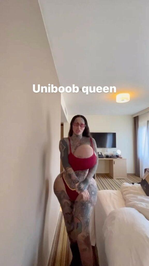 Models 38j Breast Implant Explodes Becomes The ‘uniboob Queen