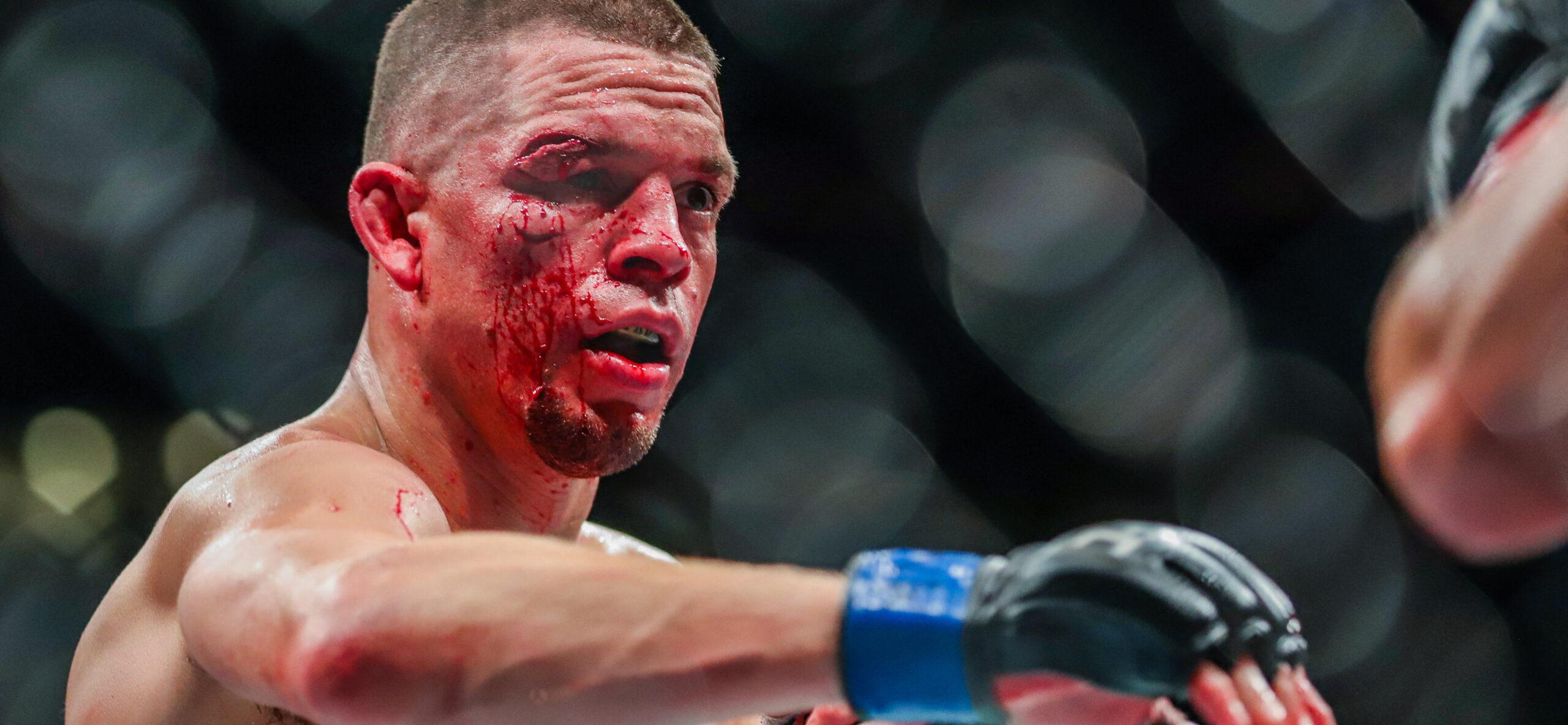 Nate Diaz Posts To Instagram Hours After Street Fight With Logan Paul Lookalike