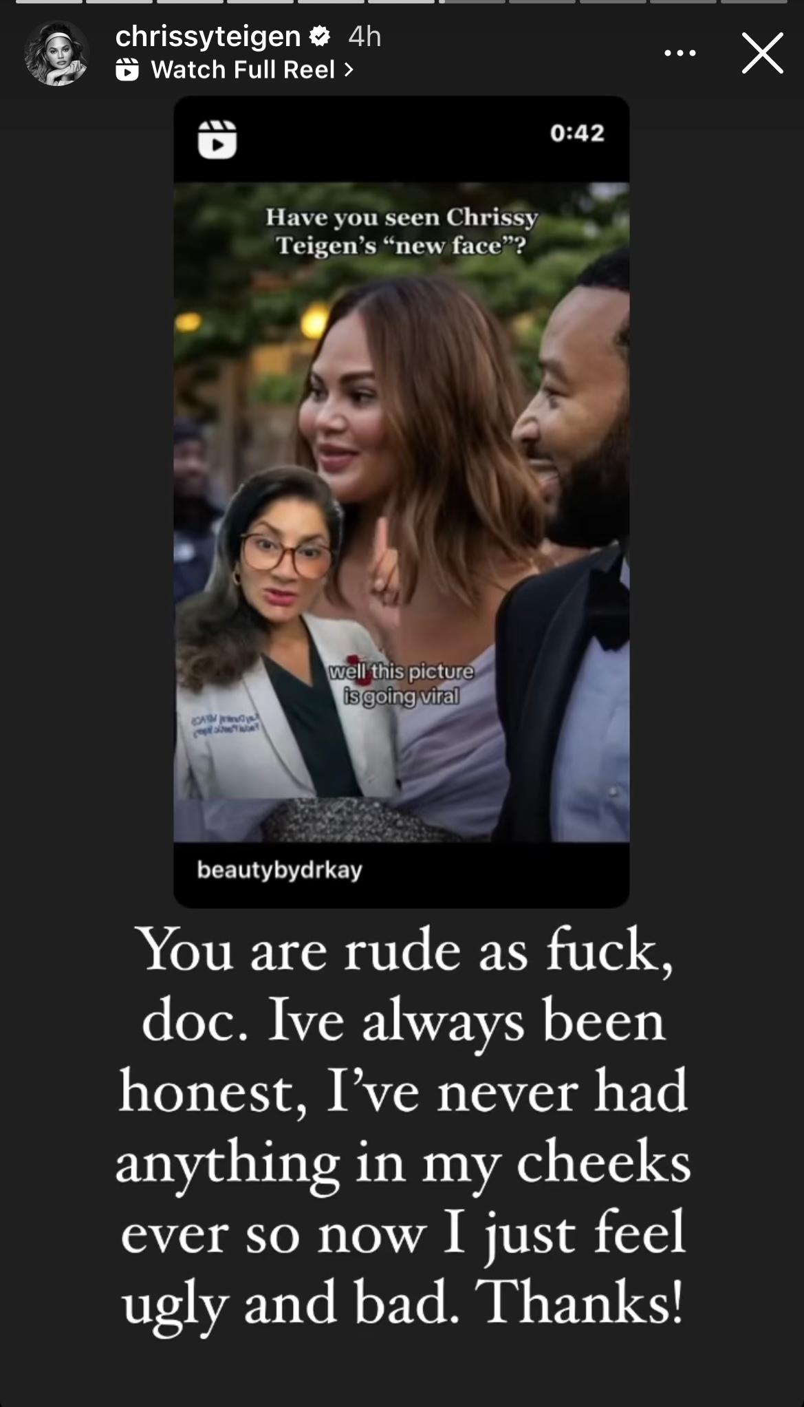 Chrissy Teigen Claps back at plastic surgeon who accused her of using cheek injectors