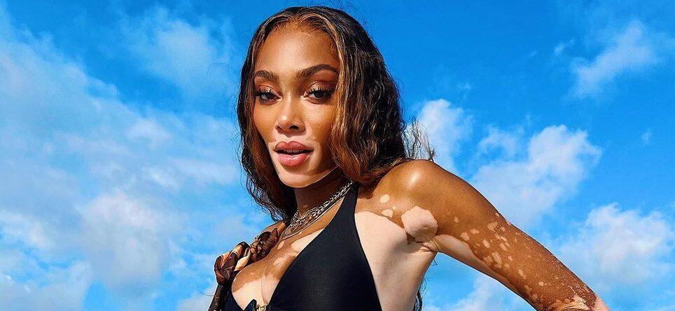 Winnie Harlow Gives Fans A Cheeky Update About Her Chest