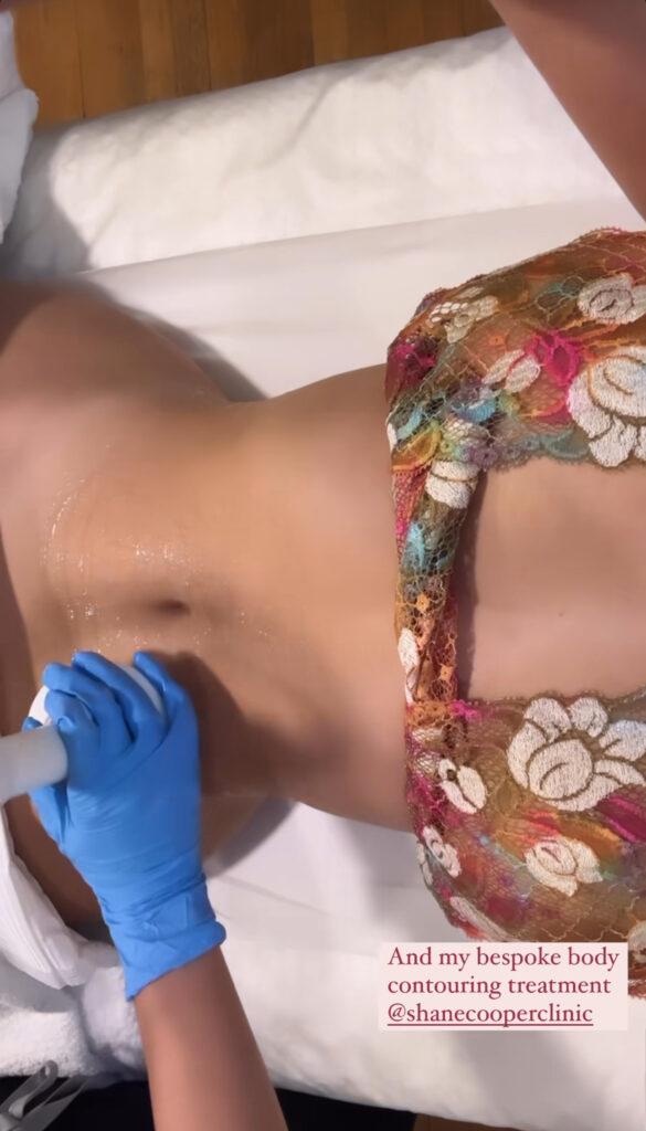 Demi Rose getting her bespoke body contouring treatment.