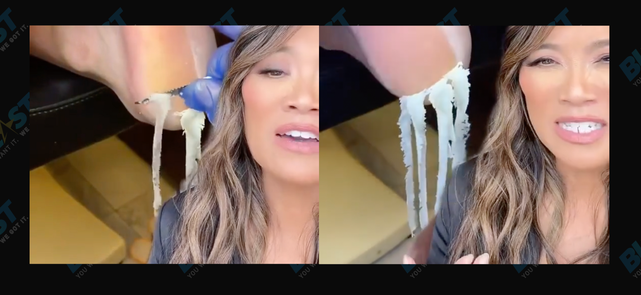 Dr. Pimple Popper — See ‘Parmesan Cheese’ Noodles Being Scraped Off Feet