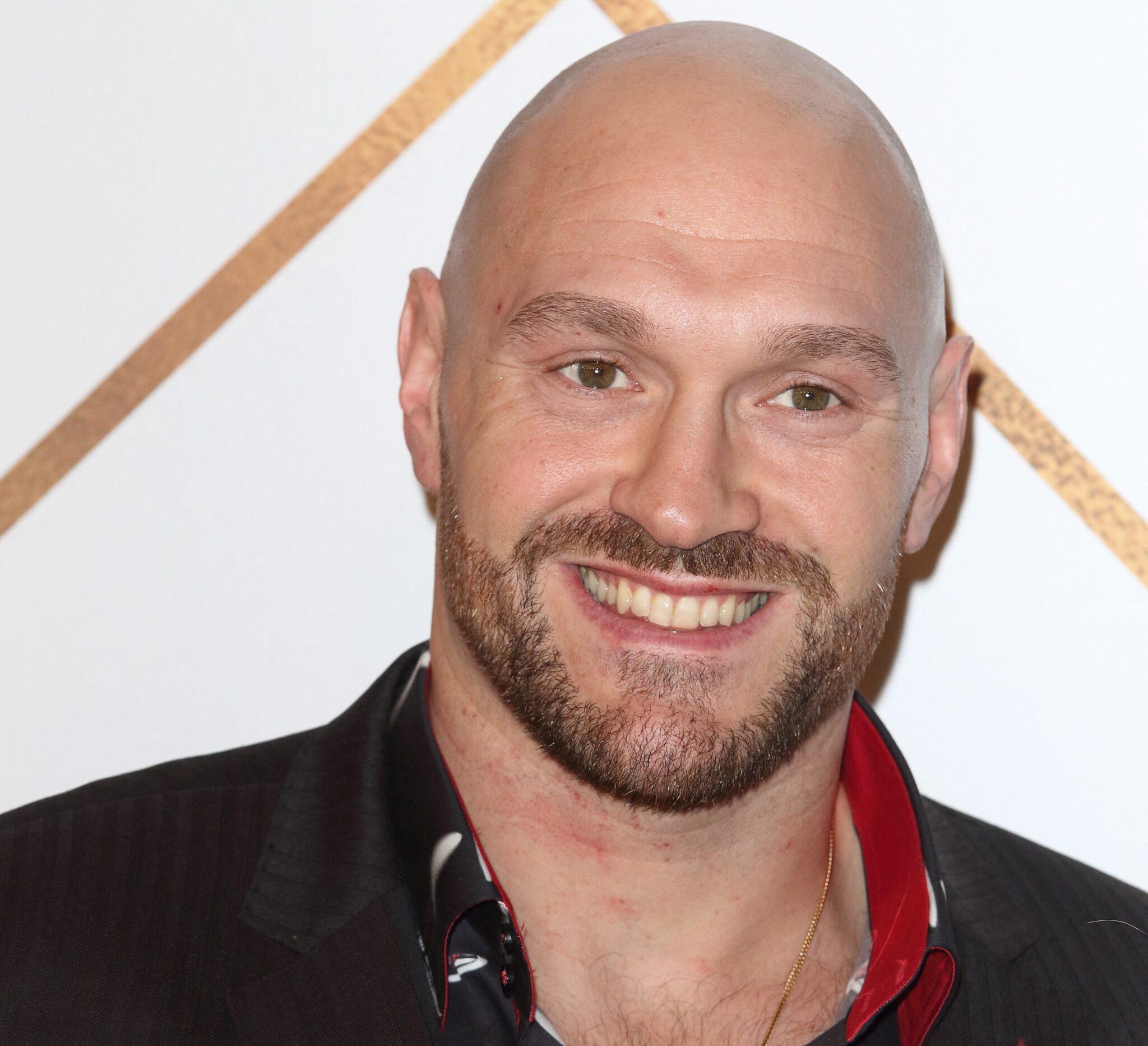Boxer Tyson Fury suffers horrific cut leaving wife 'shattered' 24ssports