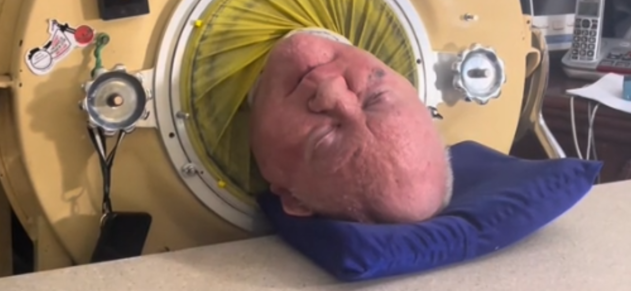 ‘The Man In The Iron Lung’ Paul Alexander’s Cause of Death Revealed