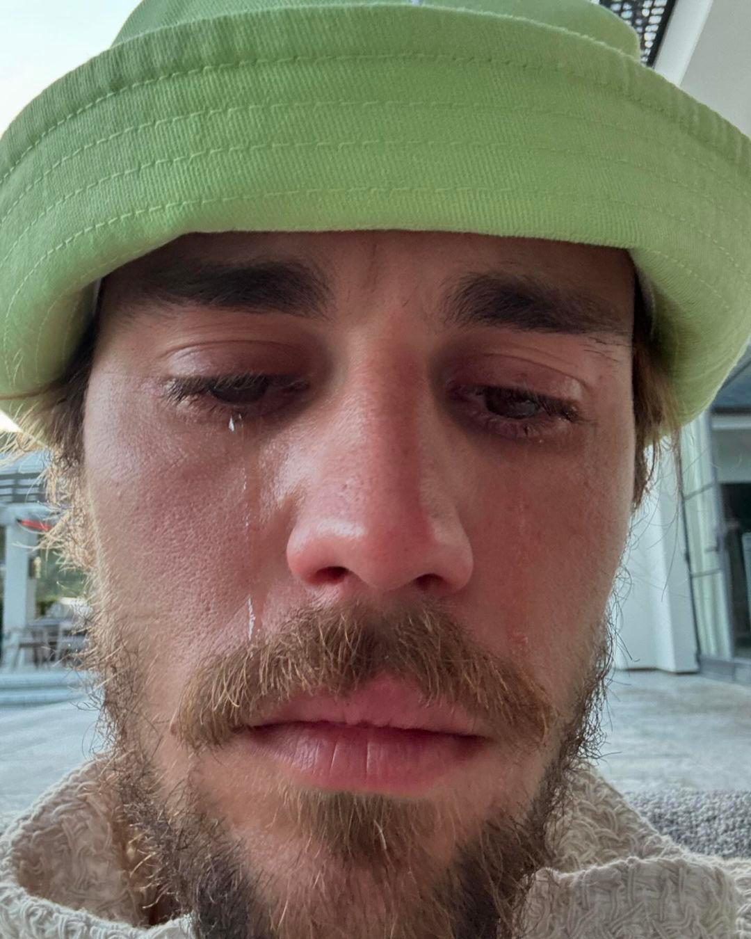 Justin Bieber Leaves Fans Worried After Sharing Emotional Crying Selfies