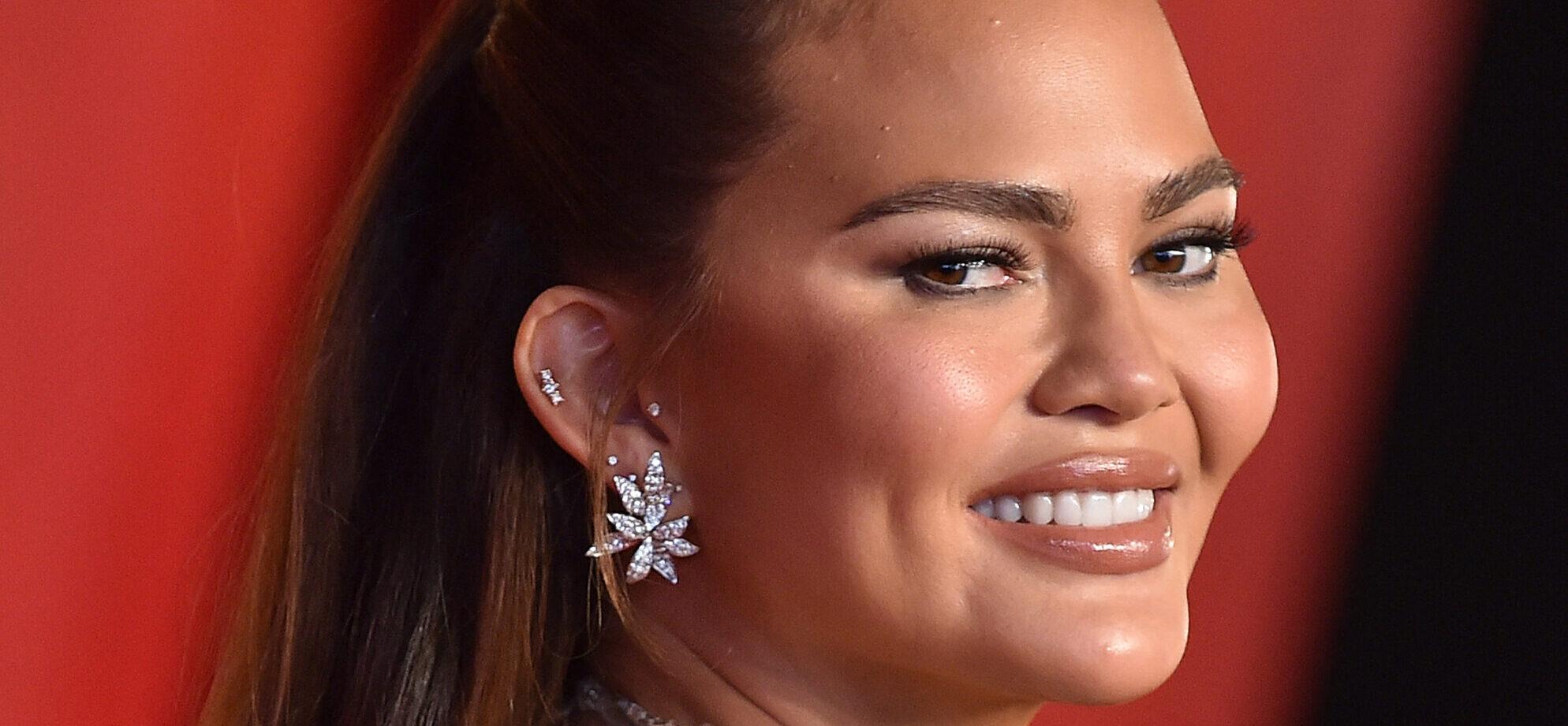 Chrissy Teigen Sparks Concern After Sharing Alarming New Photo With Face Bandages