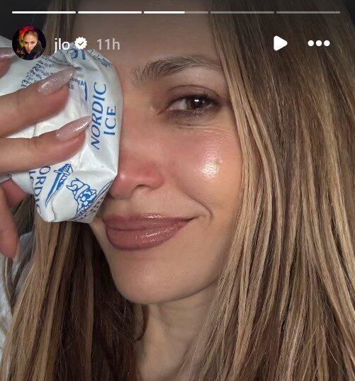 Jennifer Lopez shows injury on her face