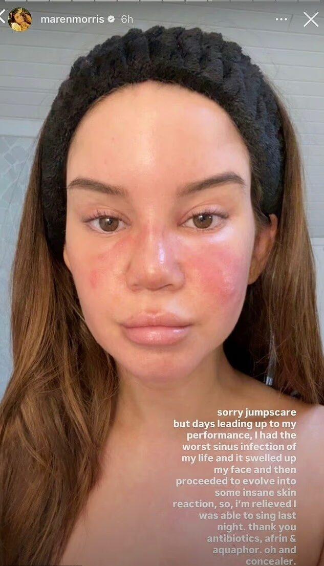 Maren Morris selfie of sinus infection