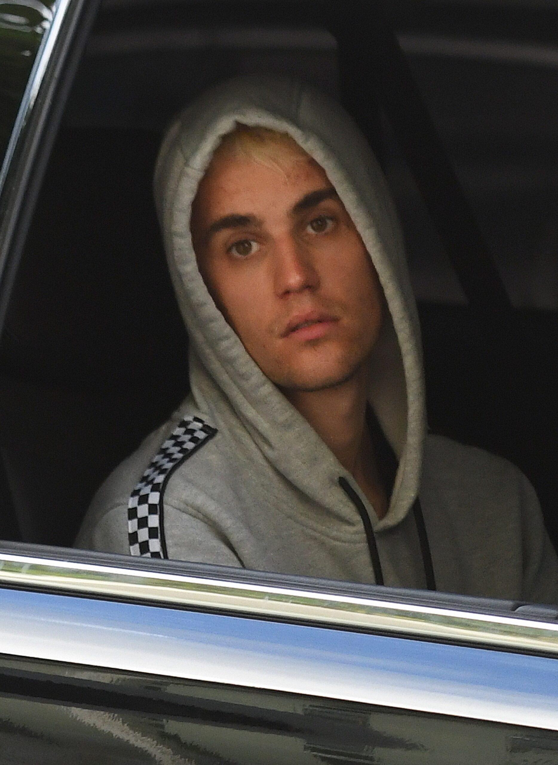 Justin Bieber looking tired in a car