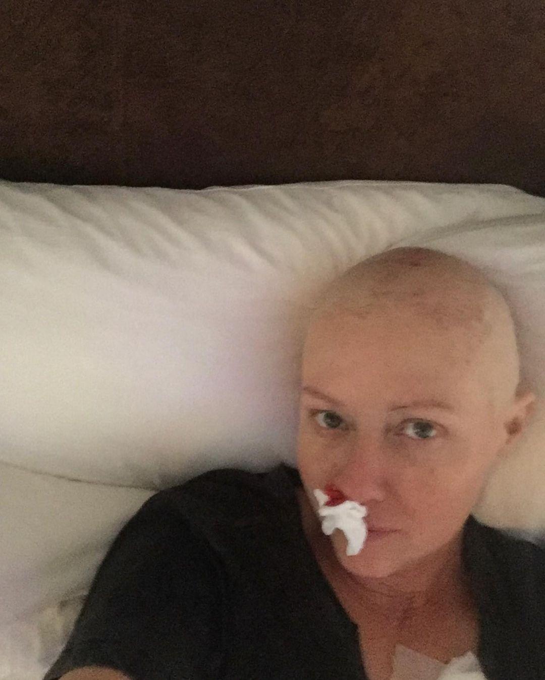 ‘90210’ Star Shannen Doherty Shares Heartbreaking Cancer Treatment Pictures