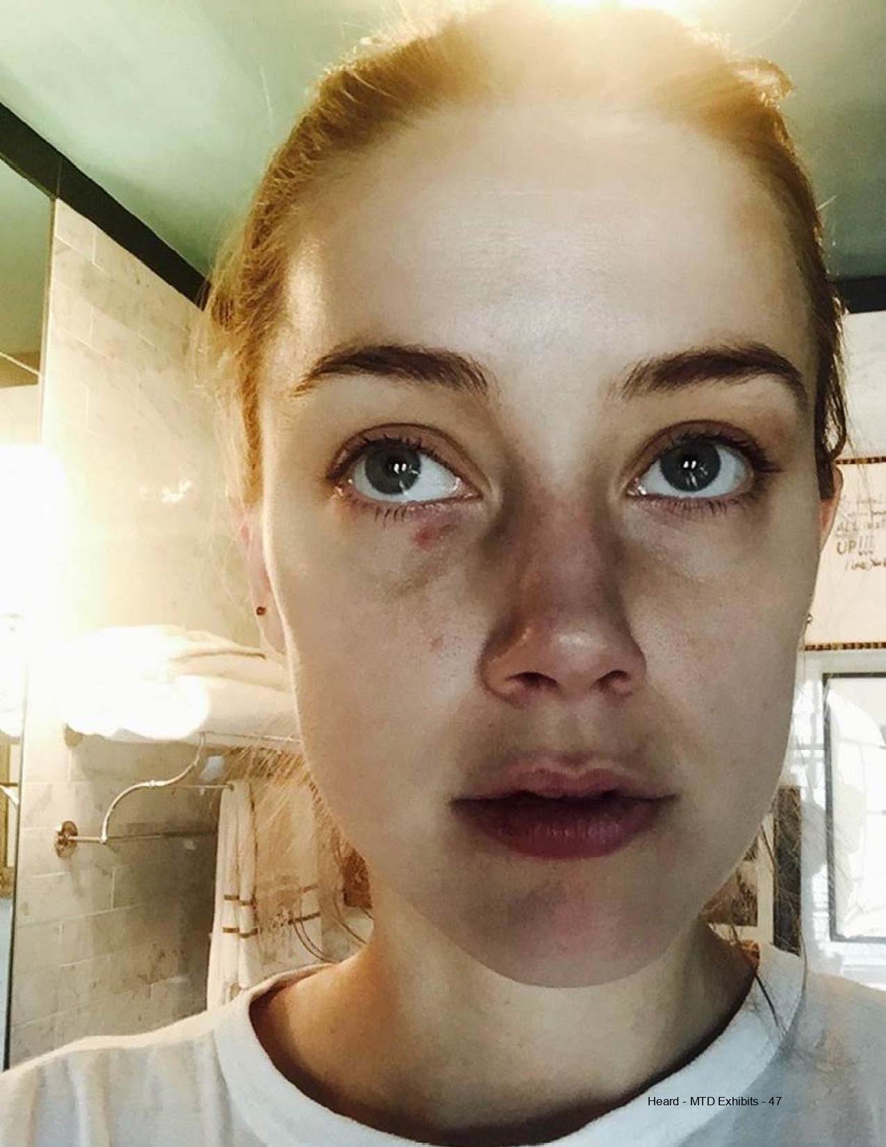 Picture used by Amber Heard to prove assualt by Johnny Depp
