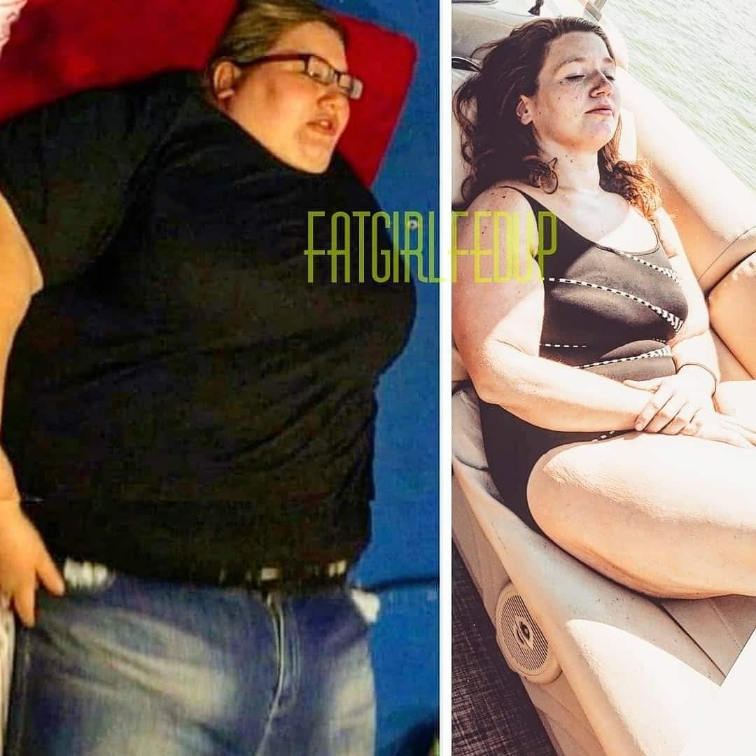 Weight Loss Influencer Hospitalized On A Ventilator, After Dropping 312 Pounds