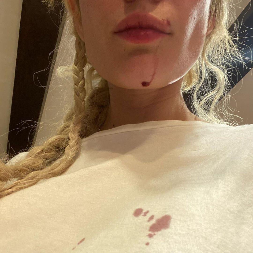 Halsey Bloodied