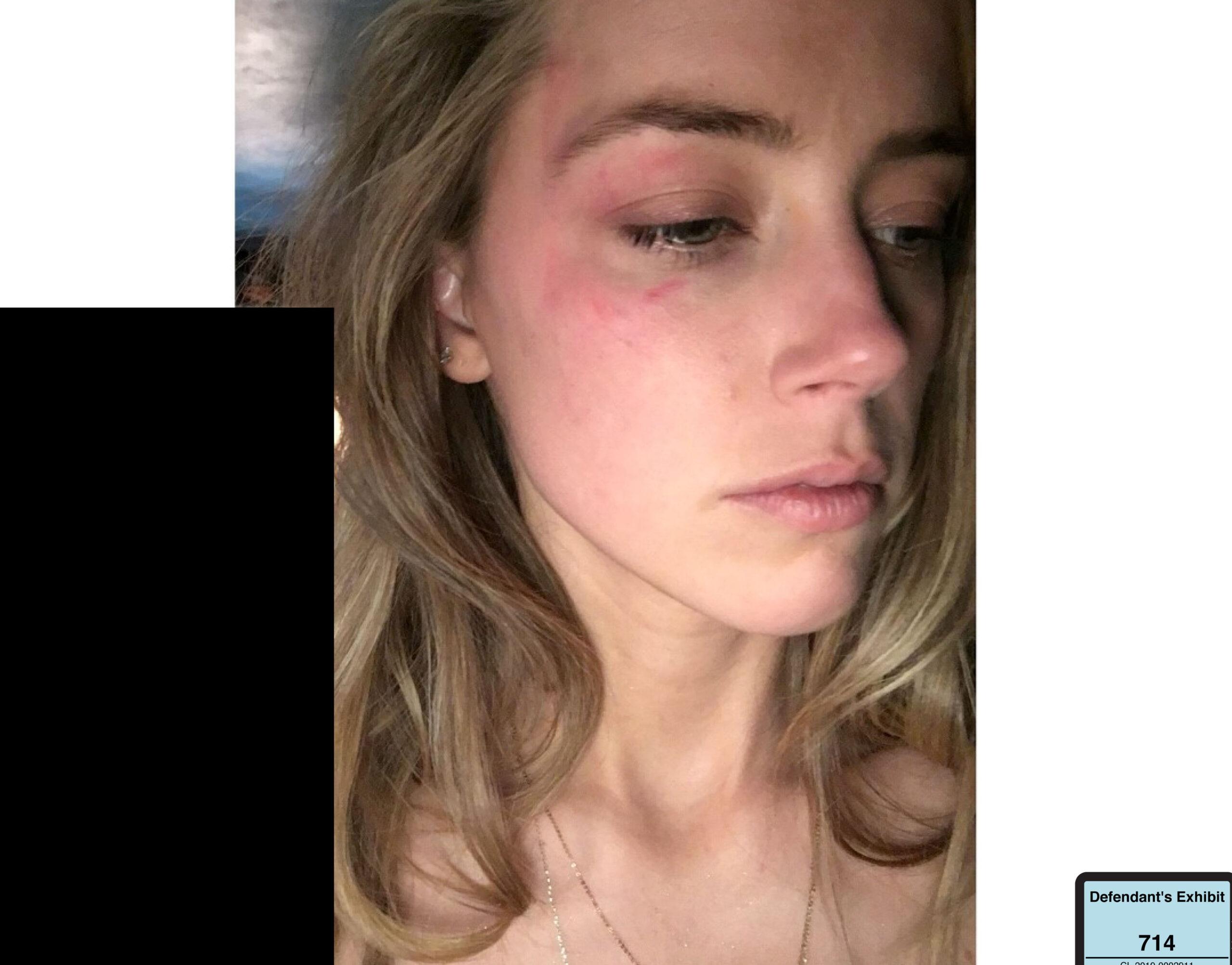 Amber Heard has been accused of editing photos of her apparently bruised face by a lawyer for Johnny Depp in the ex-couple’s defamation trial.