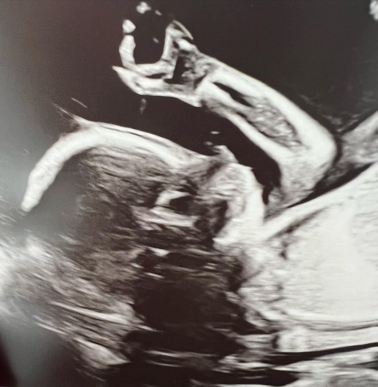 Hilaria Baldwin ultrasound 