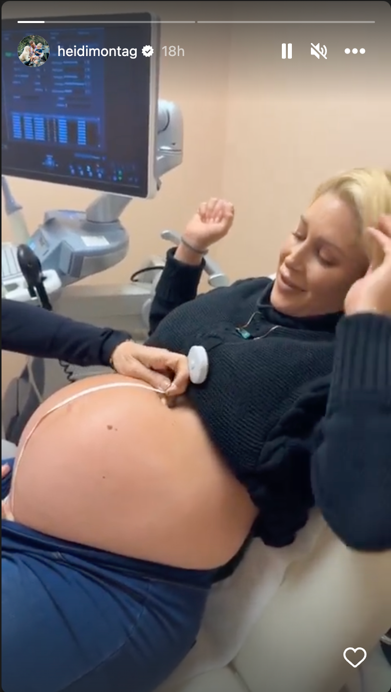 Heidi Montag Is Expecting Her Second Child Early, Documents Progress On IG