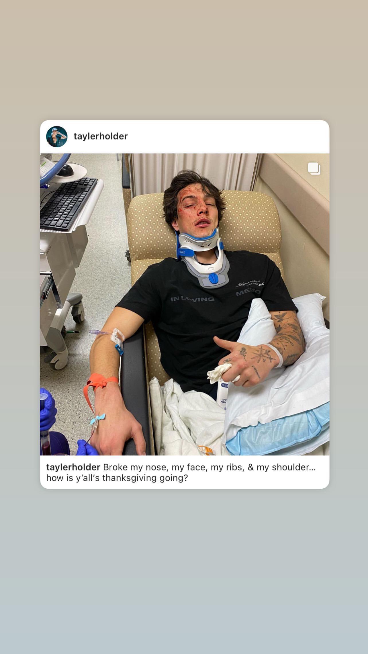 TikTok Star Tayler Holder Hospitalized, Shows Off Bloody Aftermath