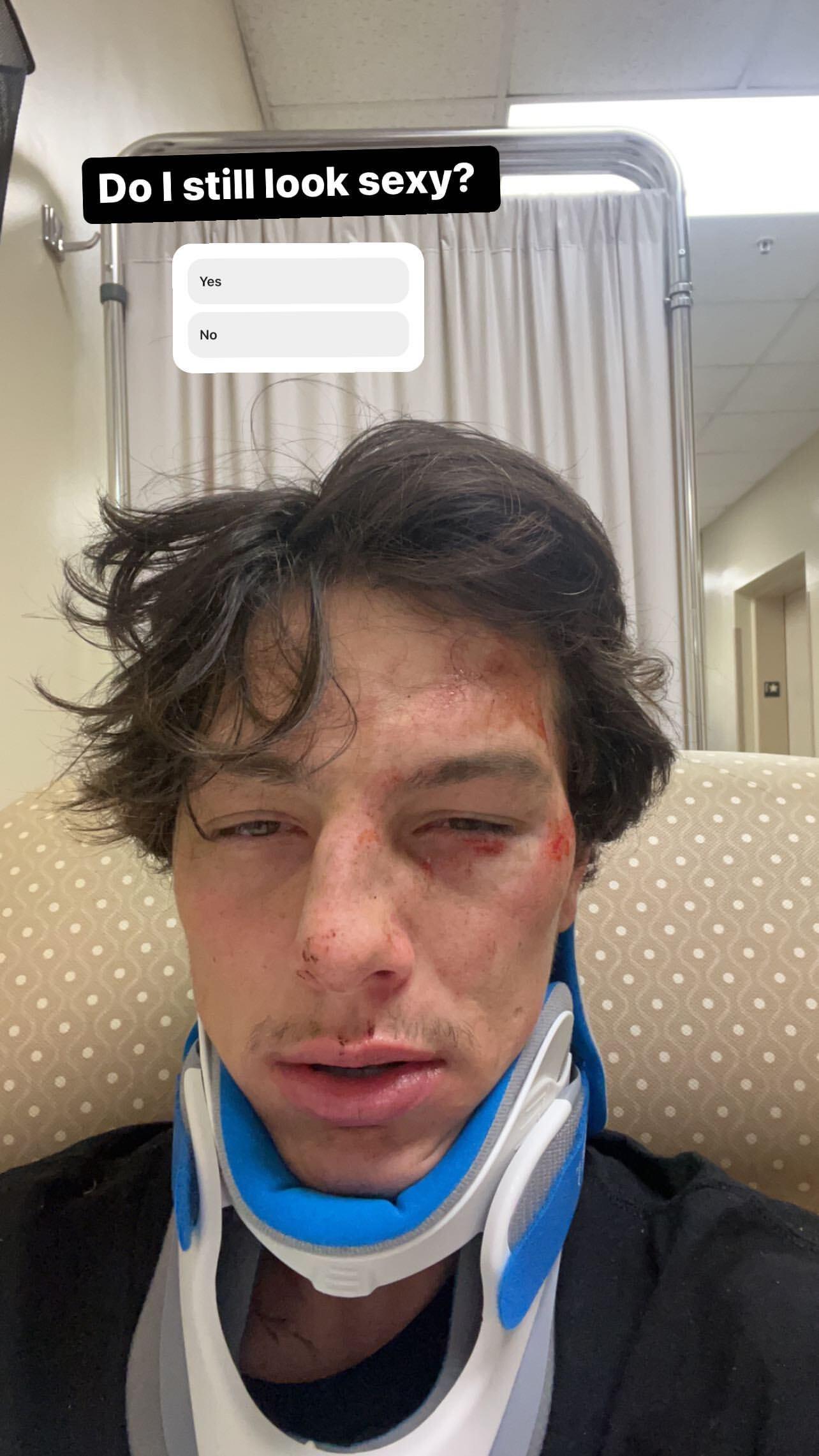 TikTok Star Tayler Holder Hospitalized, Shows Off Bloody Aftermath