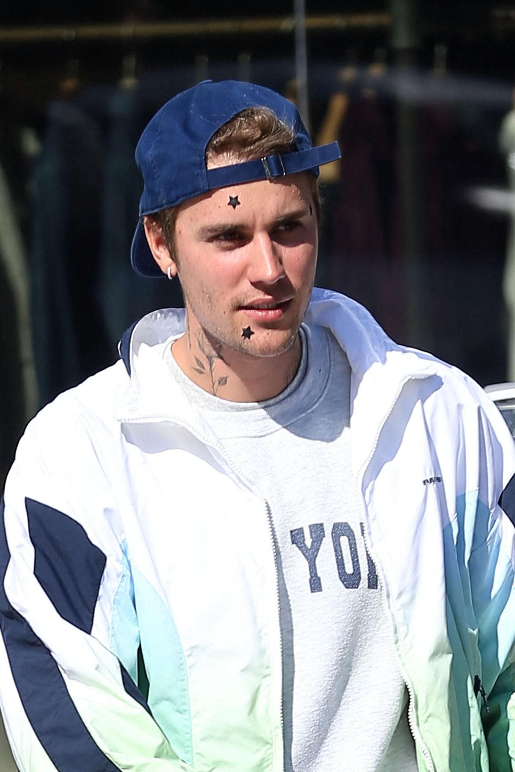 Justin Bieber appeared with three stickers on his face while in LA