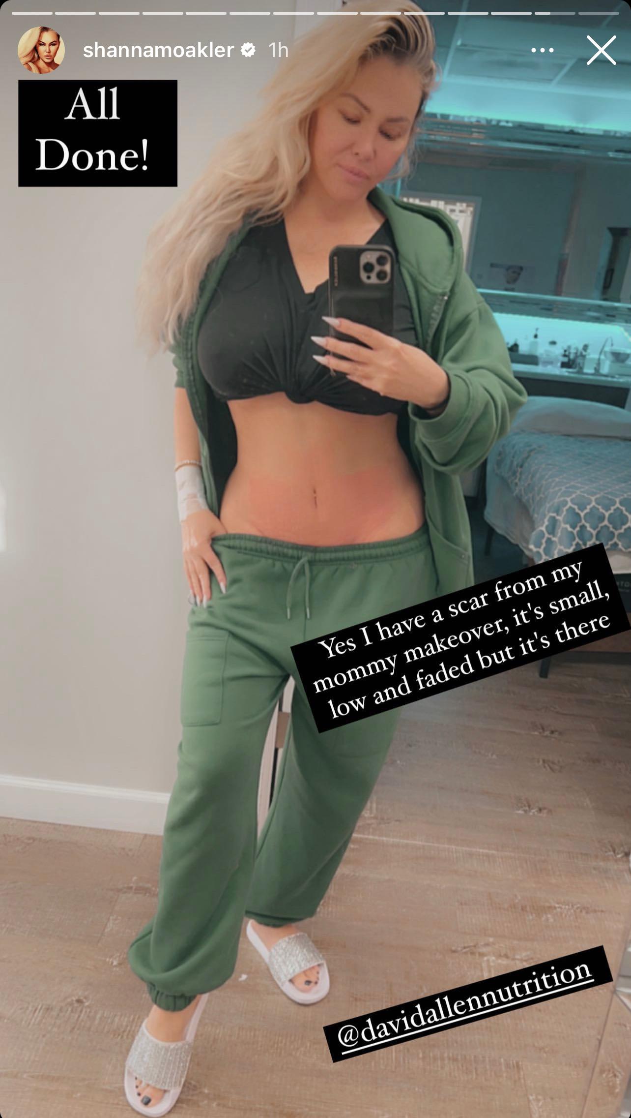Shanna Moakler Shows Off Results 5 Weeks After Tummy Tuck