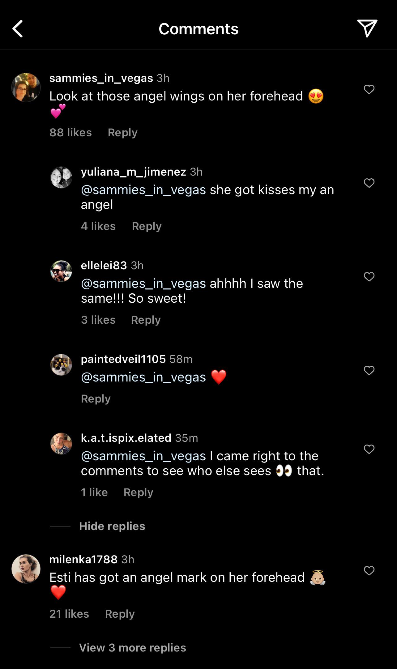 Fans Rave About 'Angel Wings' On Chrissy Teigen's New Born's Head