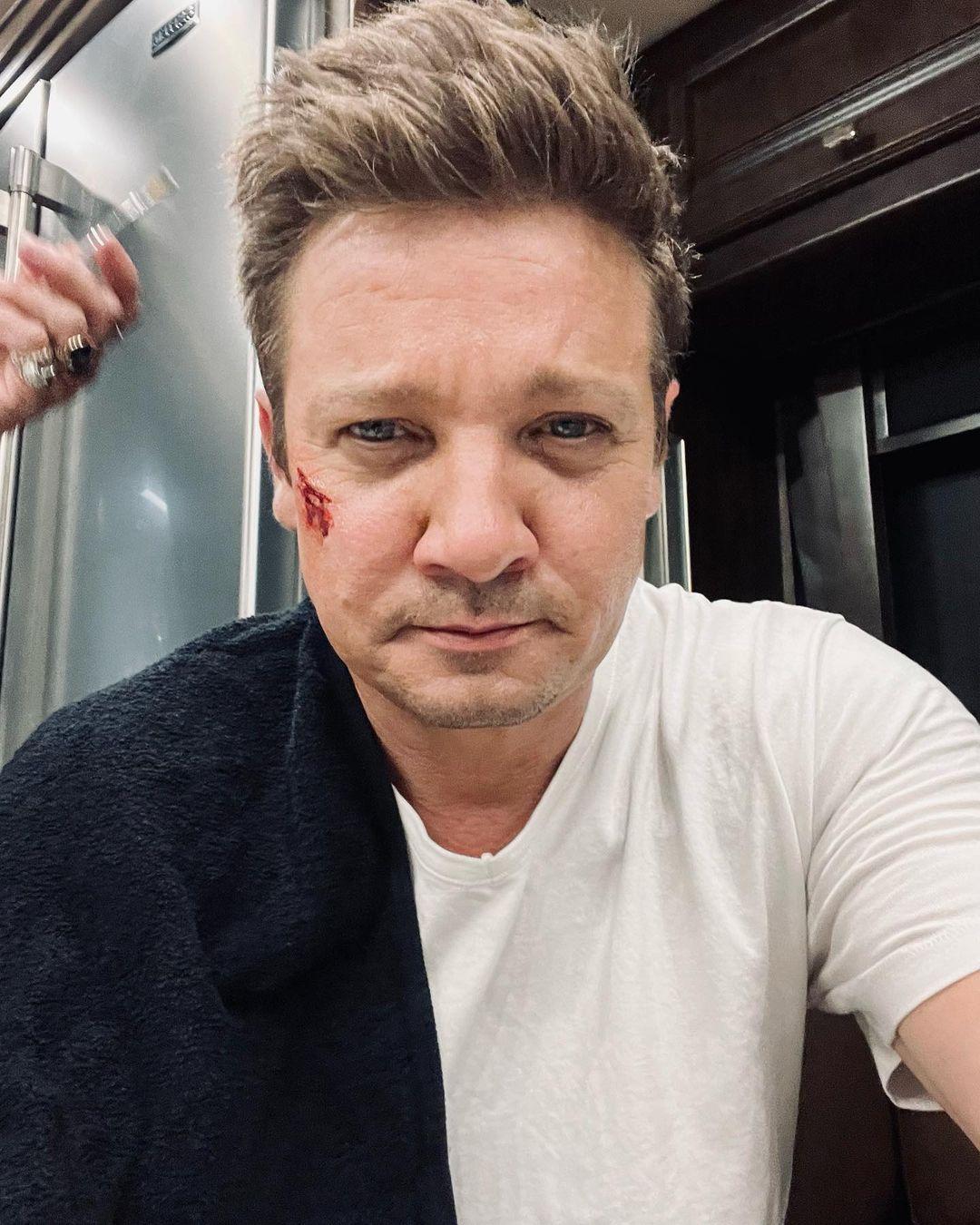 Jeremy Renner post-snow plow accident