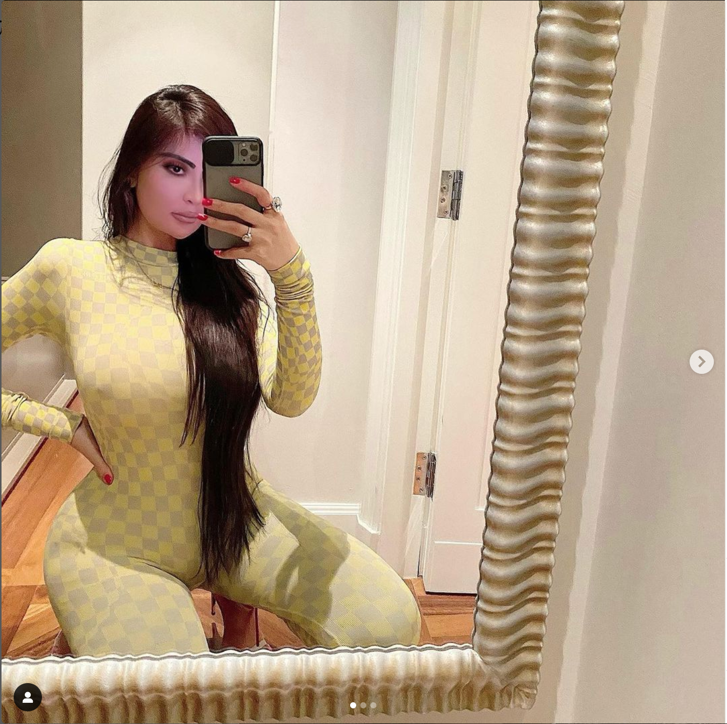 Post Surgery Kim Kardashian Look Alike Sick Of The Comparisons, Working On Reversing Procedures