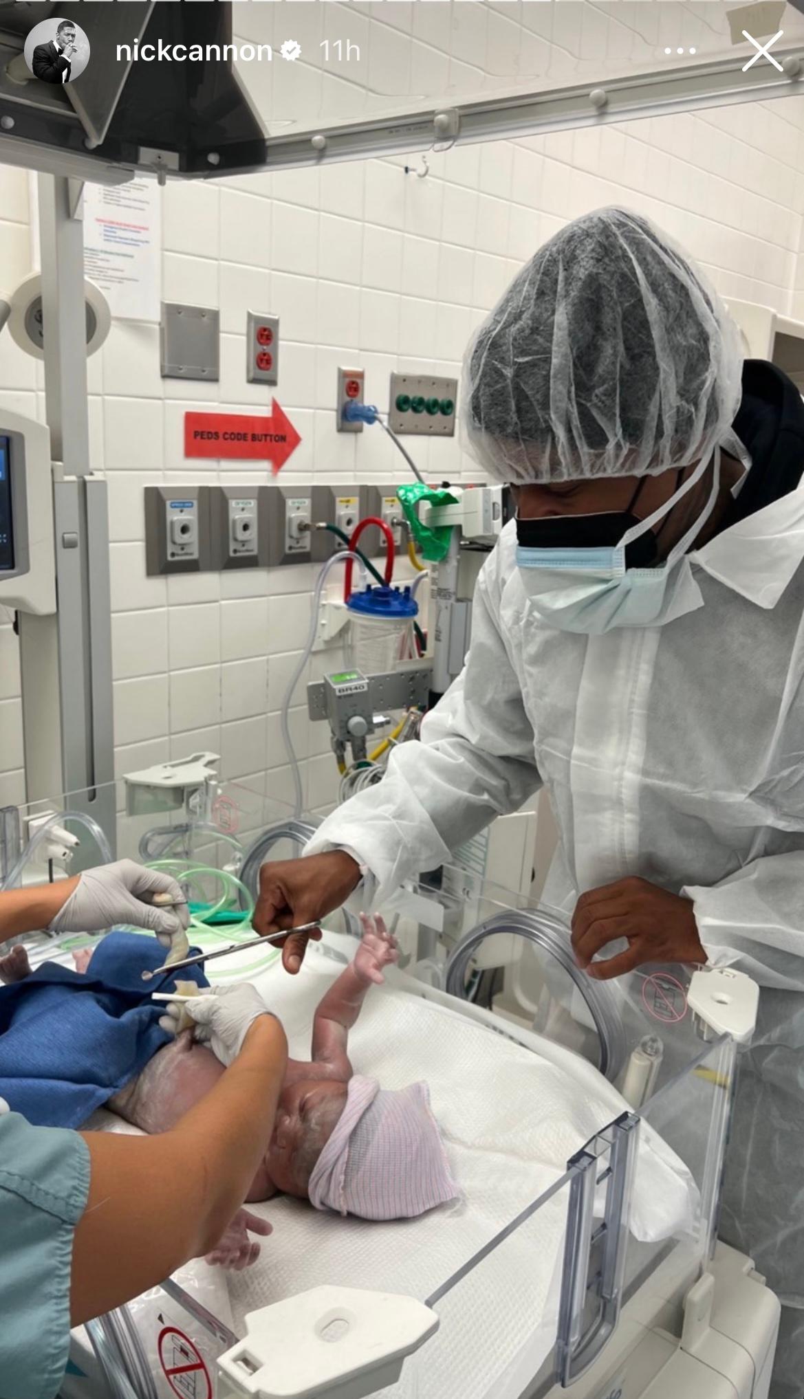 Nick Cannon shares photo of cutting daughter Onyx's umbilical cord for her 1st birthday