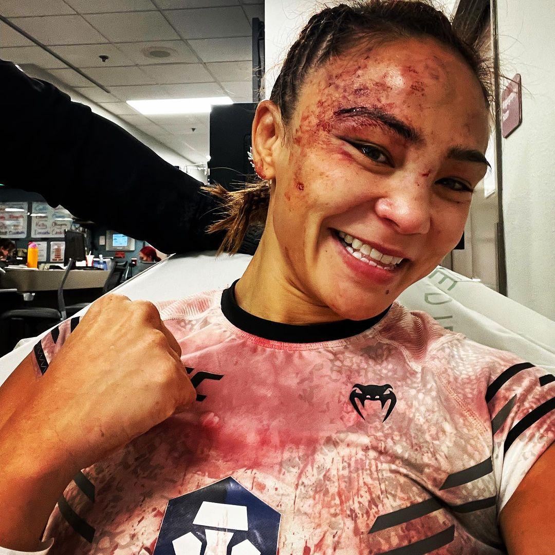 UFC Fighter Michelle Waterson-Gomez's Bloody TKO Aftermath