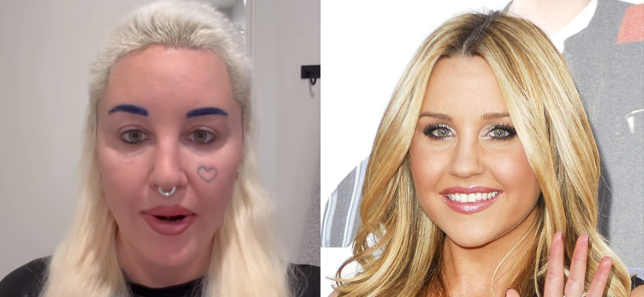 Amanda Bynes Admits She Got Plastic Surgery To Remove 'Skin Folds' From Her Eyes