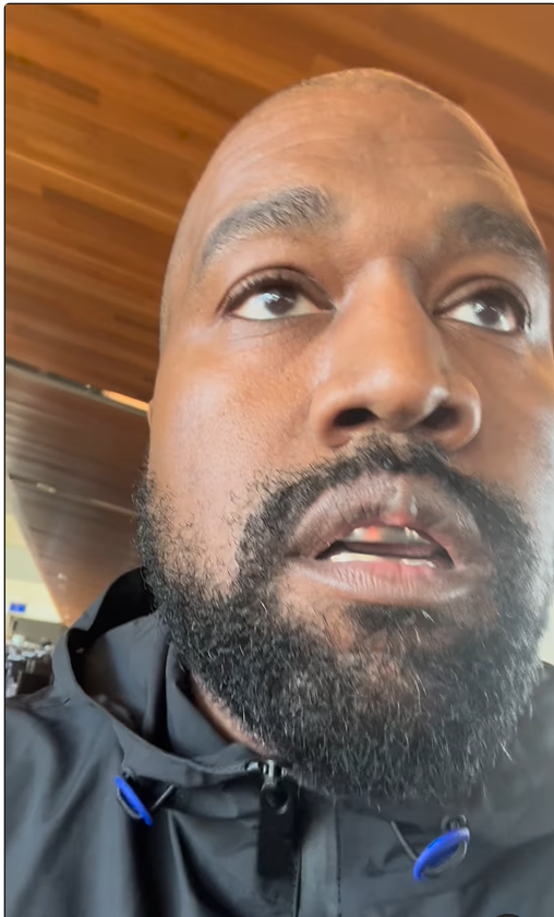 Kanye West's Fans Alarmed By 'Growth' On His Upper Lip After Getting Titanium Teeth