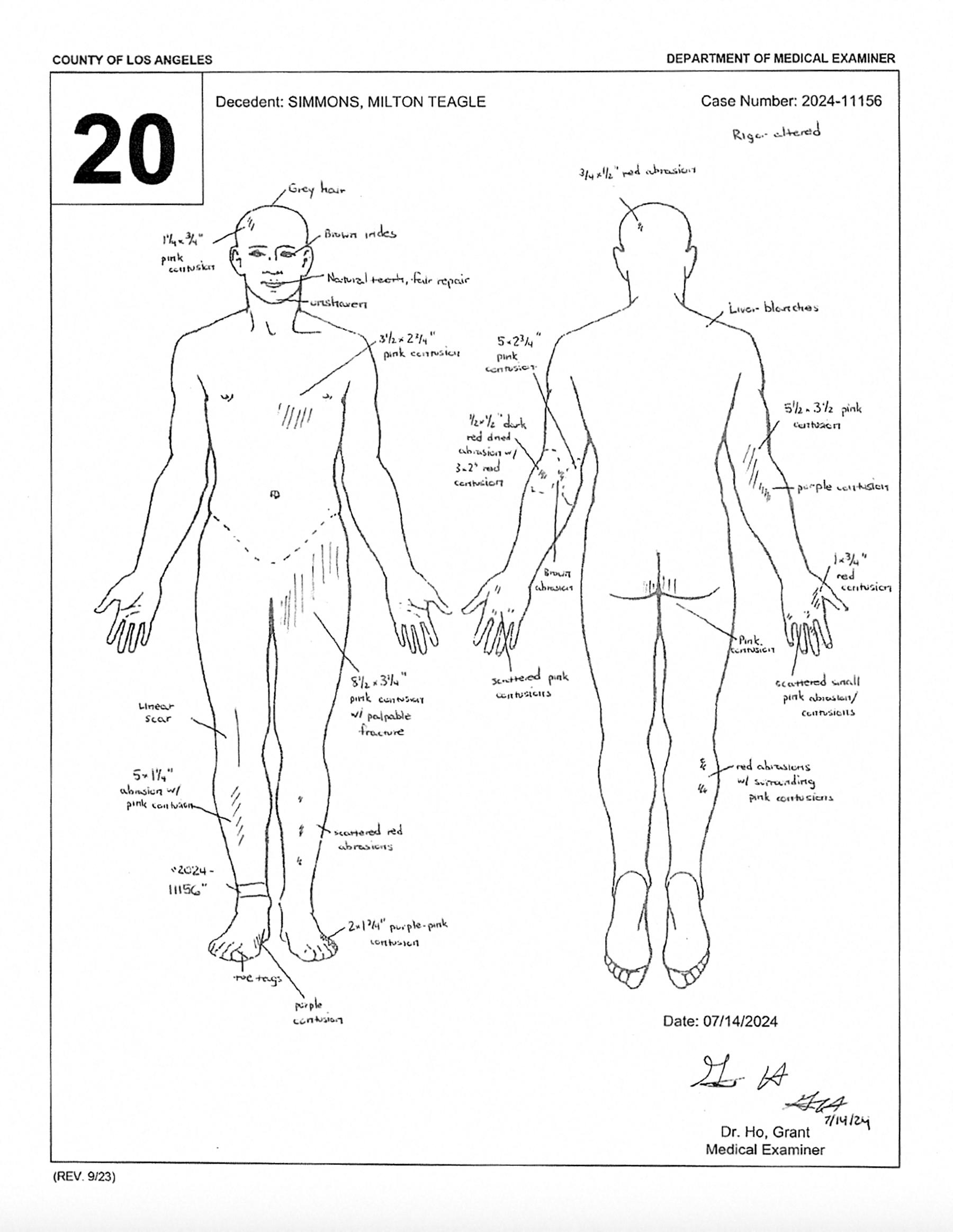 Richard Simmons' death officially classified an accident due to a 'ground level fall' - see the medical examiner's report.