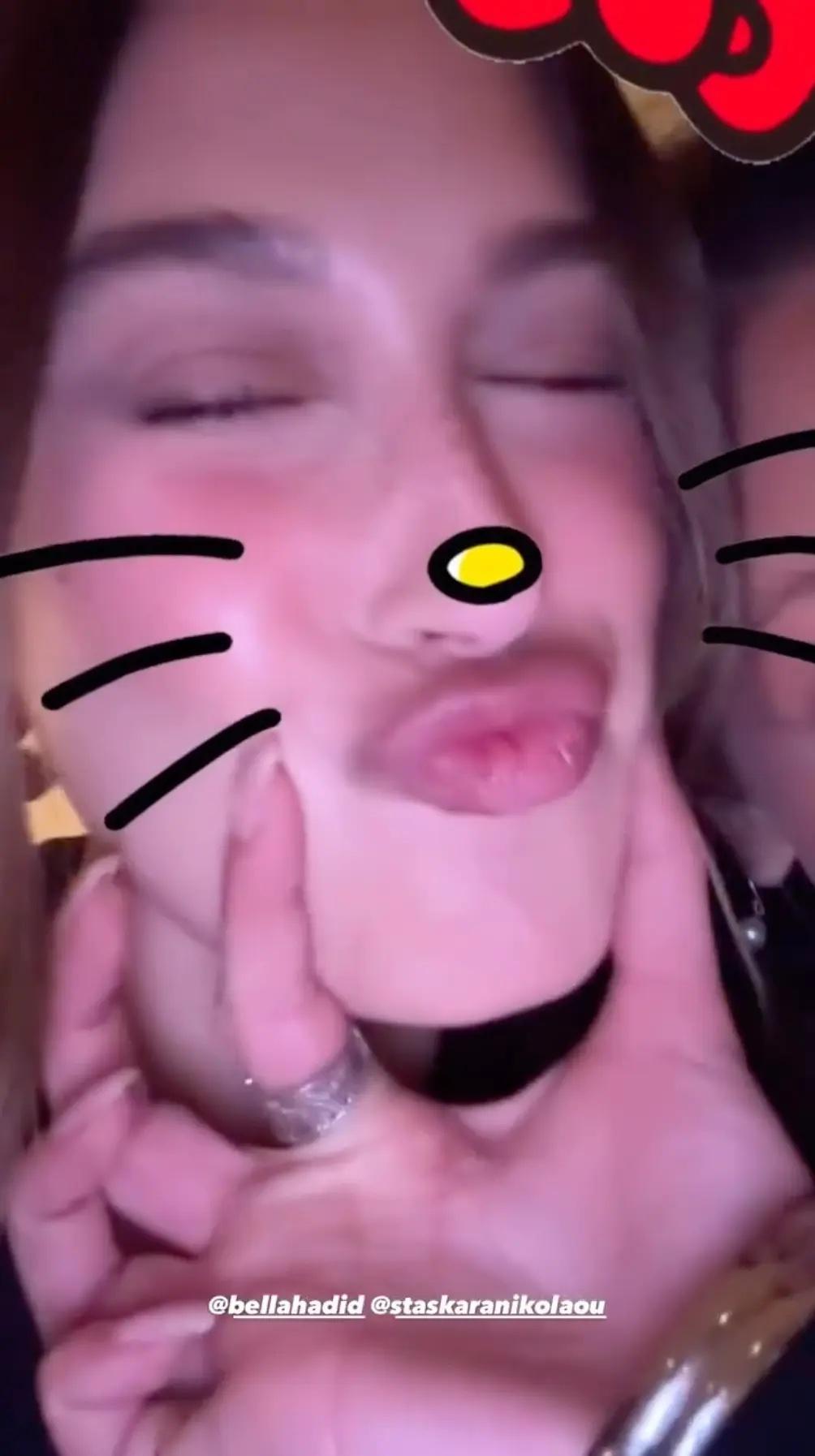 Hailey Bieber puckers up