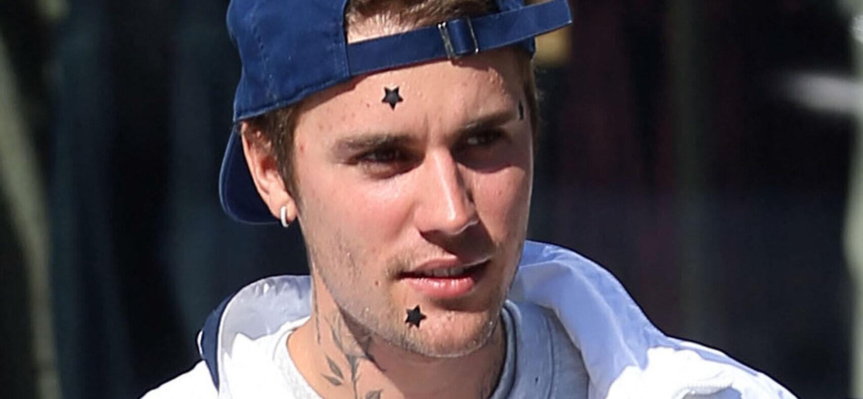 Justin Bieber with stickers on his face