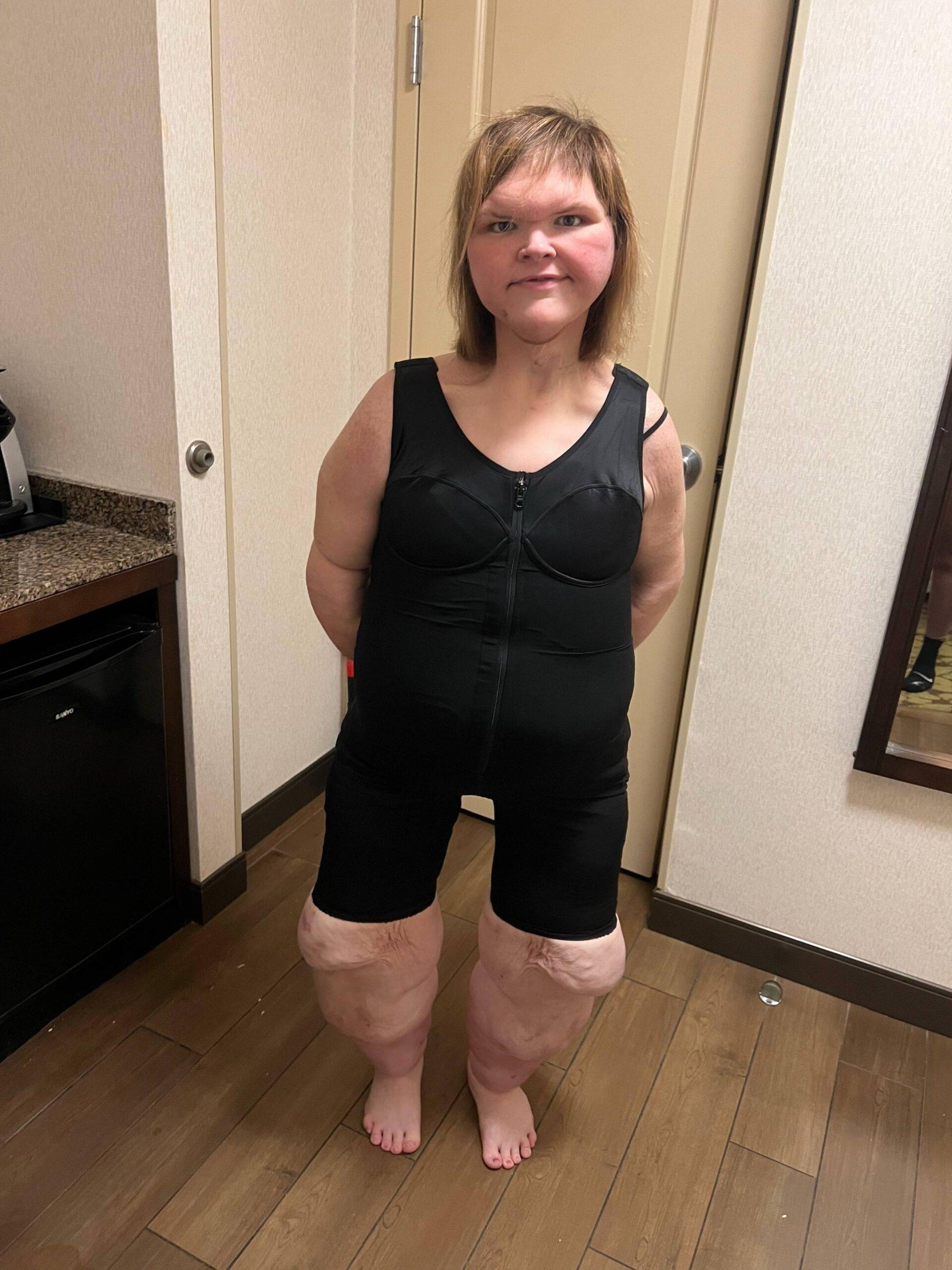 Tammy Slaton