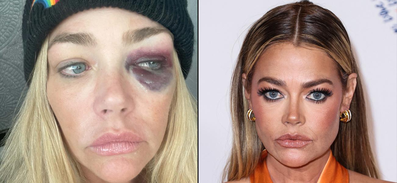 Denise Richards