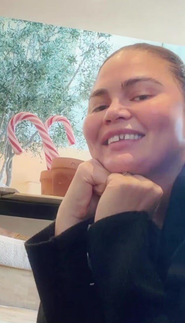 Chrissy Teigen showing off her chipped tooth