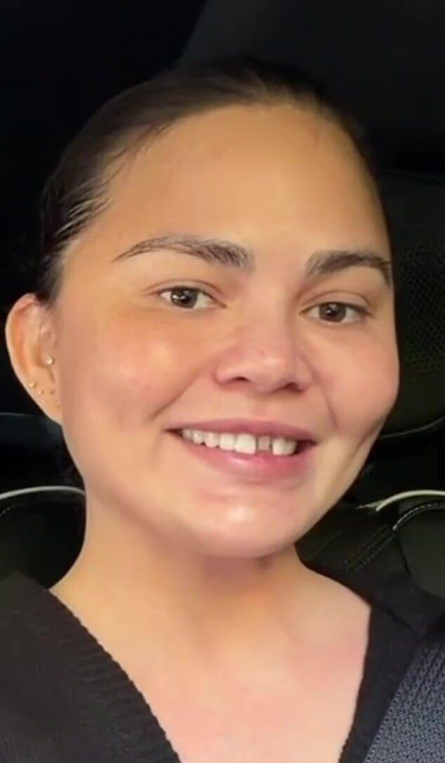 Chrissy Teigen mostra um dente lascado