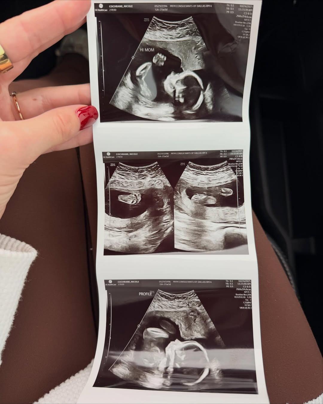 Nicole Faith holding photos of her sonogram