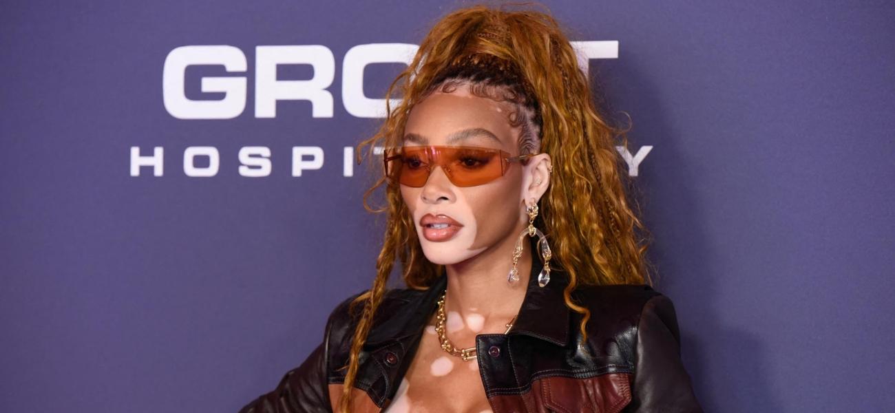 Winnie Harlow In White Bikini Tagged ‘Ugly’ And ‘Ungrateful’