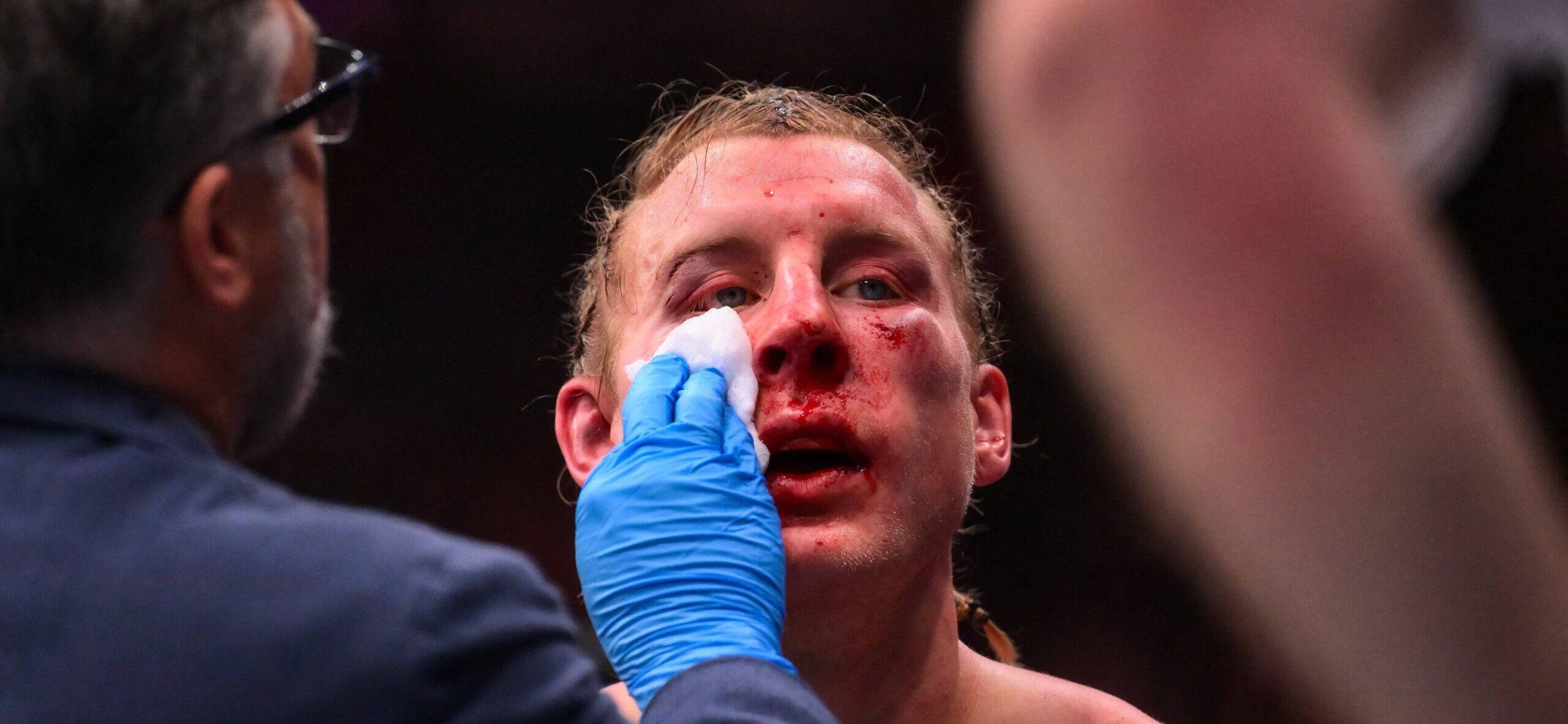 Paddy Pimblett hospitalizado após luta no UFC 324 o deixar sangrando