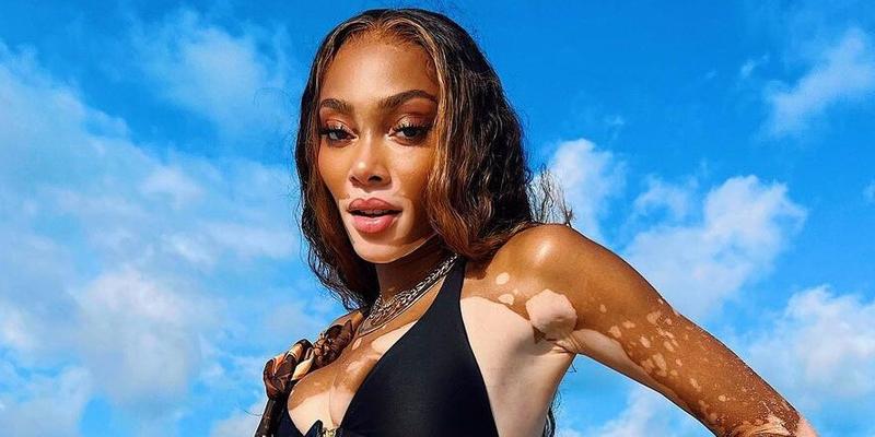 Winnie Harlow gave fans a cheeky update on breasts