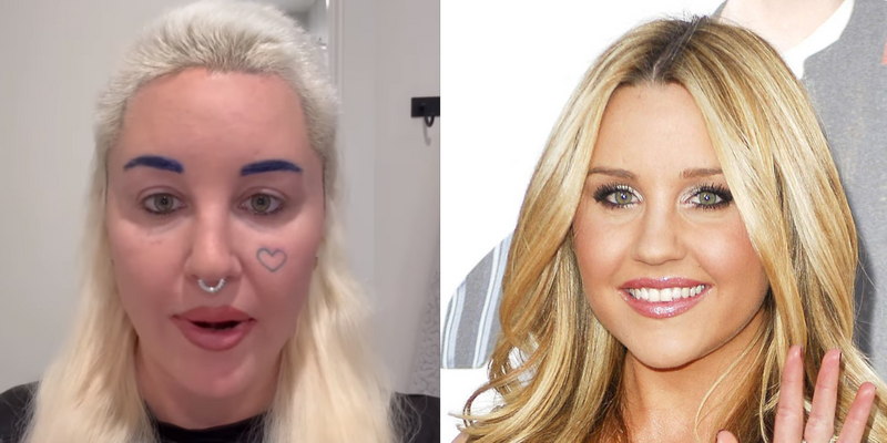 Amanda Bynes Admits She Got Plastic Surgery To Remove 'Skin Folds' From Her Eyes
